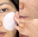 Фото Пілінг пади для очищення та звуження пор Medicabe Zero Pore Pads 2.0 70 шт. 100206, вид 2,